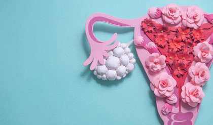 Concept,Polycystic,Ovary,Syndrome,,Pcos,Awareness.,Women,Reproductive,System.,Paper